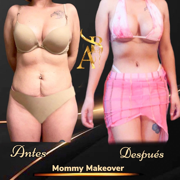 Slider image (2) Dr. Joaquin Ayala - Best Plastic Surgeon in Tijuana Mexico